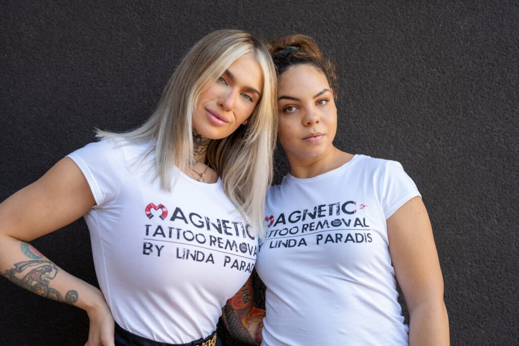 Non-Laser Solution for Tattoo Removal in the USA