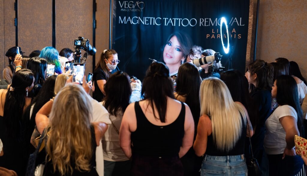 How Magnetic Tattoo Removal works How Magnetic Tattoo Removal works